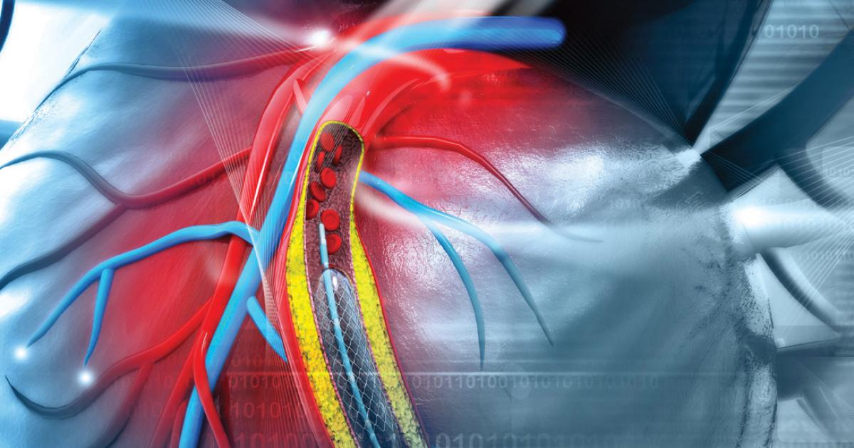 Machine learning helps ward off med-induced heart trouble