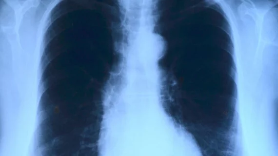 chestxray.jpg chestxray.jpg