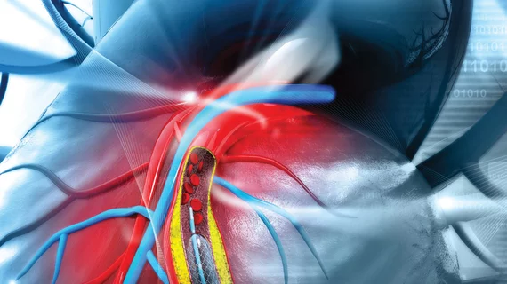 arrhythmia.jpg arrhythmia.jpg